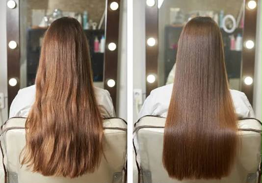 Botox & Hair Straightening Treatment
